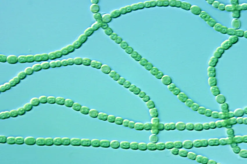 a string of cyanobacteria