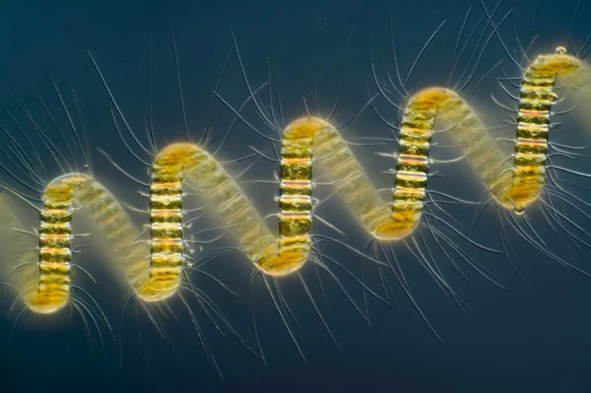 A spiraled diatom with spines. 