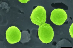 green colored cells of the bacterium prochlorococcus