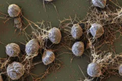 a close up of archaea cells