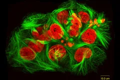 Cancer cells treated with discodermolide, a chemical from a sponge found on deep-sea coral reefs.