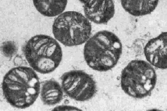 Methane-eating bacteria (also called methanotrophs) helped clean up the Gulf oil spill, such as Methylococcus capsulatus shown here.