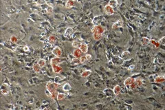 These cells are from a pygmy sperm whale in a laboratory culture dish. The red dyed cell are forming into fat cells after exposure to endocrine disruptors.