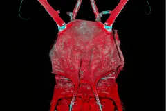 Deep-sea Copepod Head