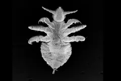 a scan of a louse