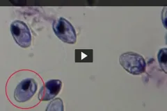 Video of a myxozoan (Myxobolus klamathellus) firing its stinging cell. Video credit:&nbsp;Myxozoan polar tubules display structural and functional variation, Parasites &amp; Vectors.&nbsp;