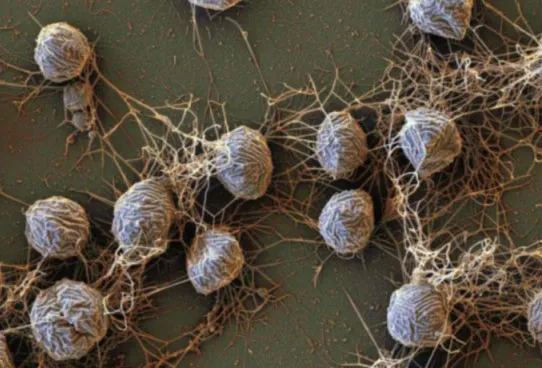 a close up of archaea cells