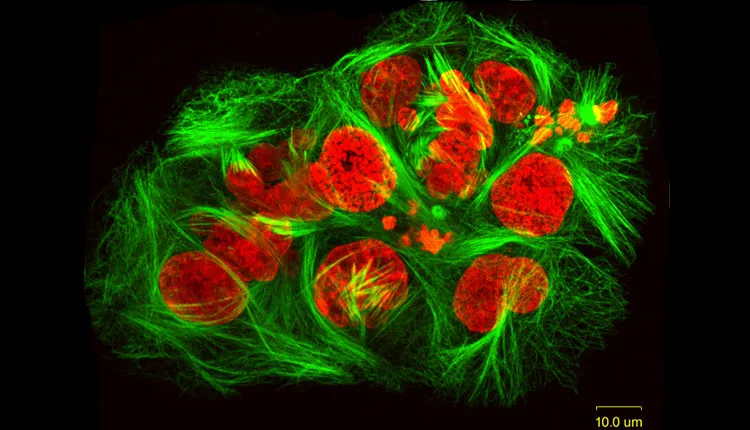 Cancer cells treated with discodermolide, a chemical from a sponge found on deep-sea coral reefs.