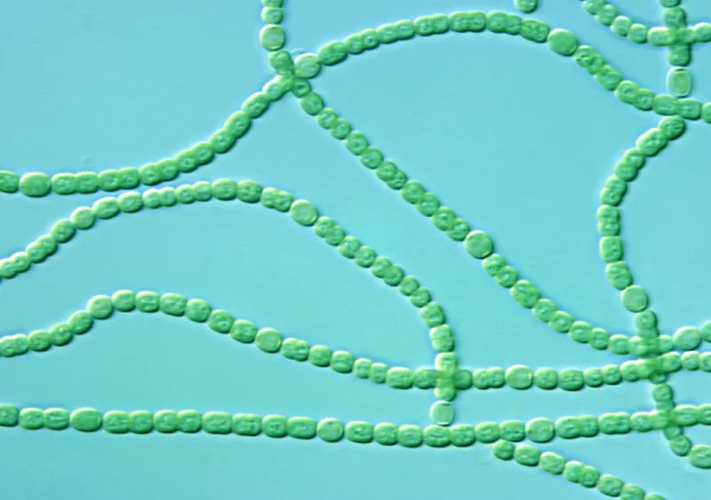 a string of cyanobacteria