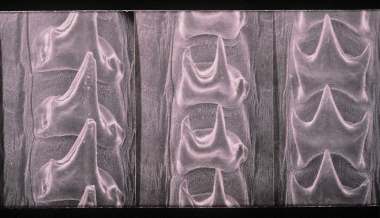 An image of a squid radula from a scanning electron micrograph. 