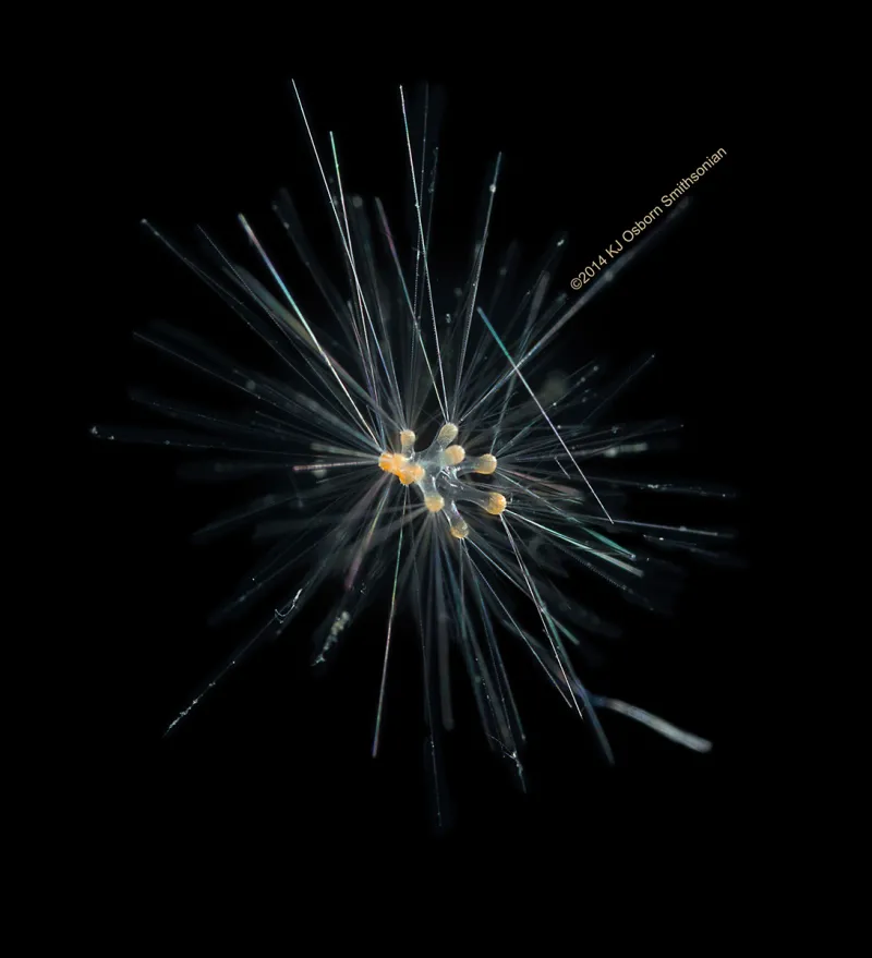 Hastigerinella digitata's many spines support sticky, hair-like “fishing lines” made from cytoplasm (the living part of a cell – mostly fluid, salts and proteins) that entangle prey.