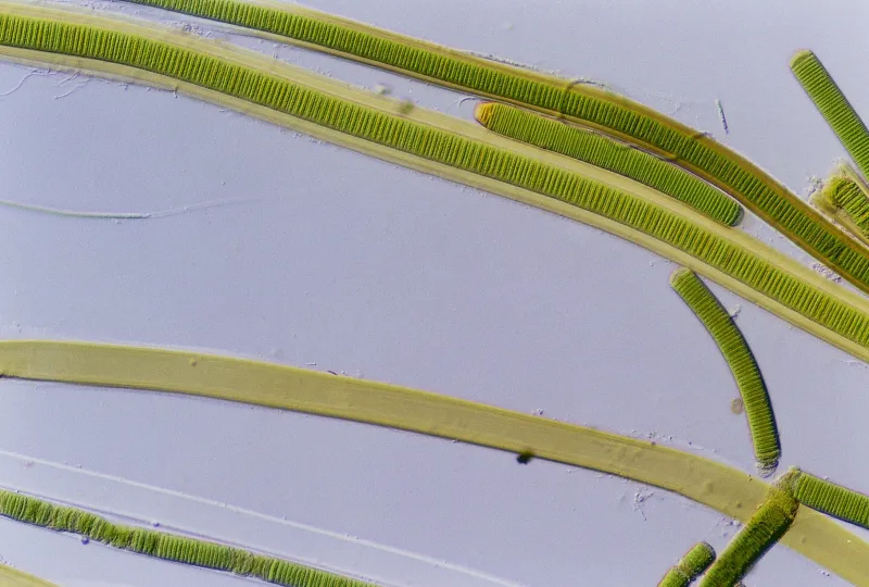 spindles of magnified green algae