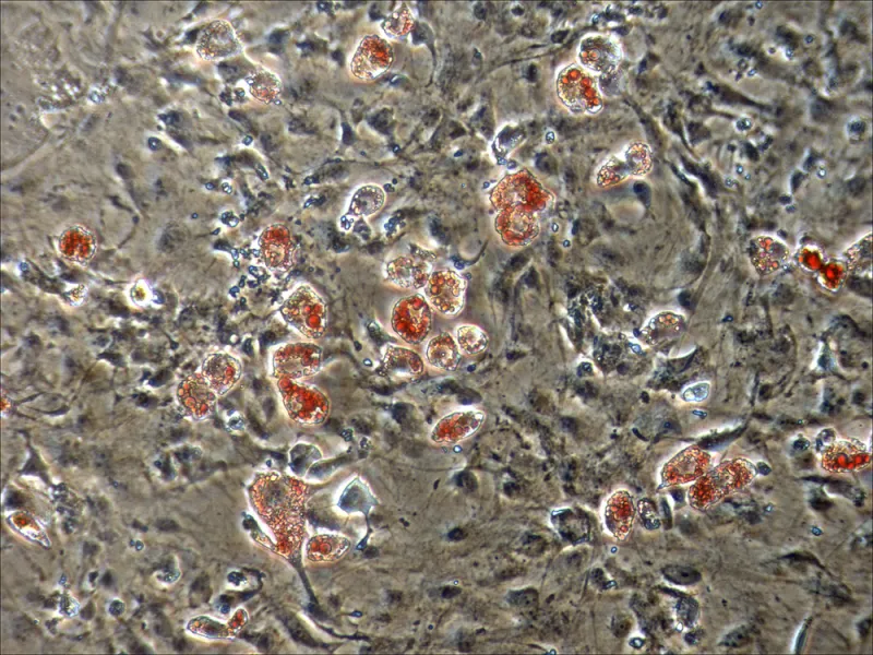 These cells are from a pygmy sperm whale in a laboratory culture dish. The red dyed cell are forming into fat cells after exposure to endocrine disruptors.