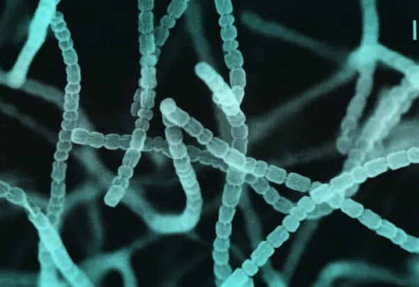 A stained close up of a microbe
