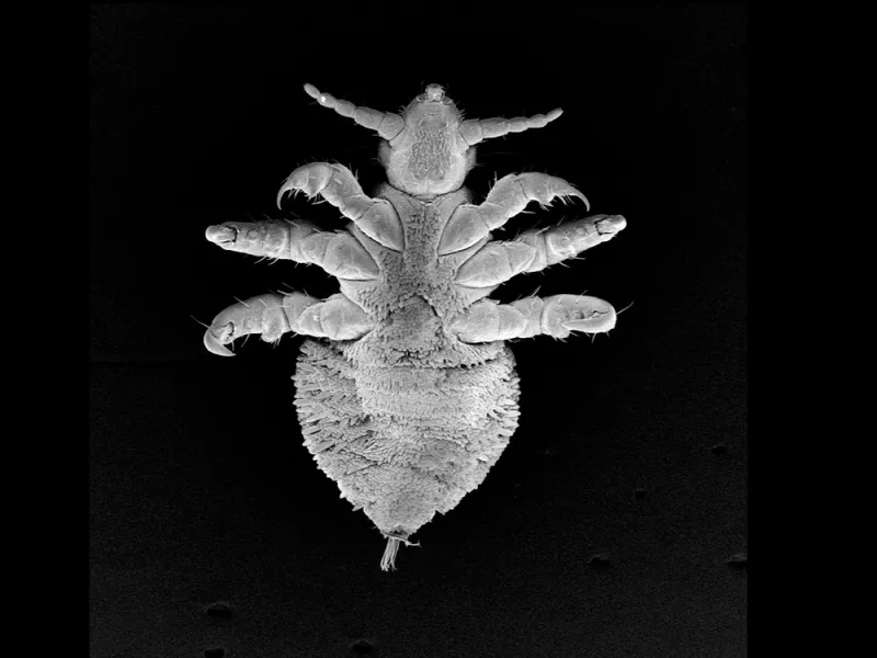 a scan of a louse