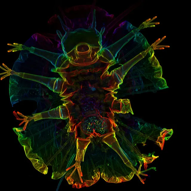 Tardigrade Under the Microscope