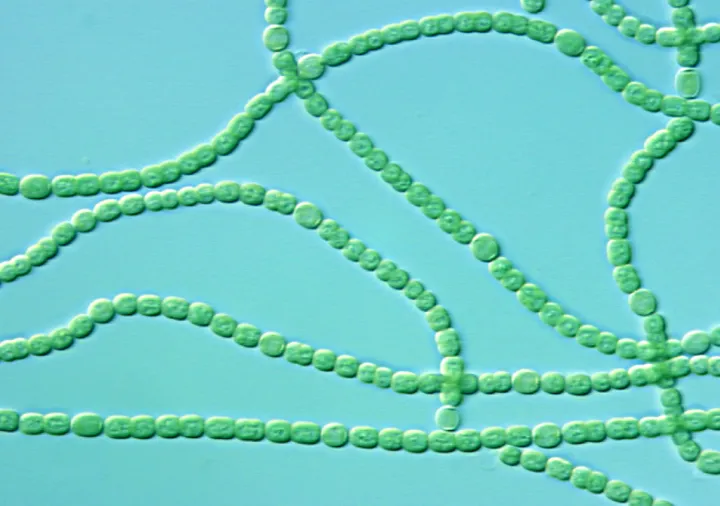 a string of cyanobacteria