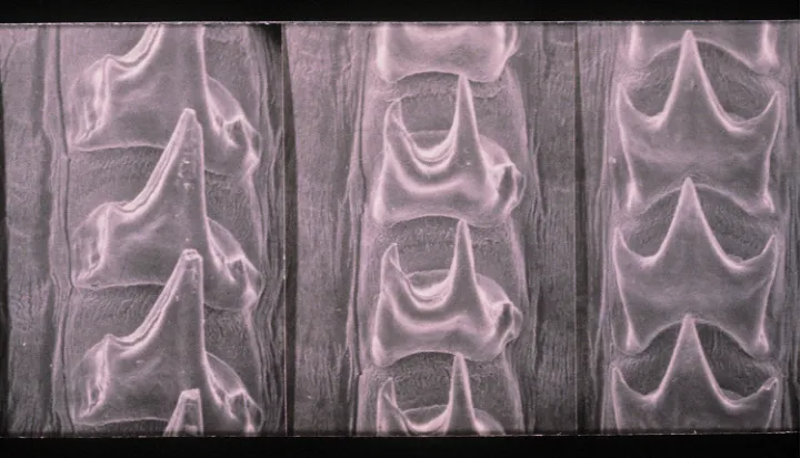 An image of a squid radula from a scanning electron micrograph. 
