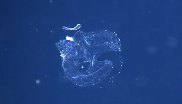 A deep-water larvacean (aka “sea tadpole”) inside its home.