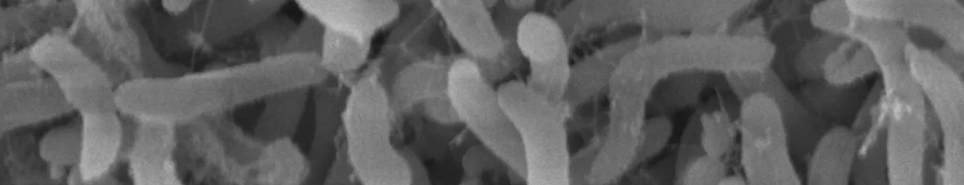 Black and white magnified image of SAR11.