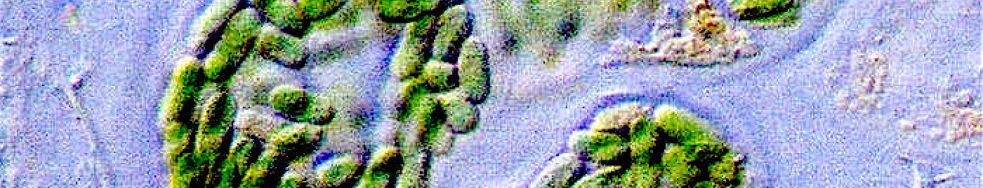 Microscope image of bacteria from microbial mat in Mexico.