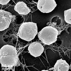 Methanocaldococcus